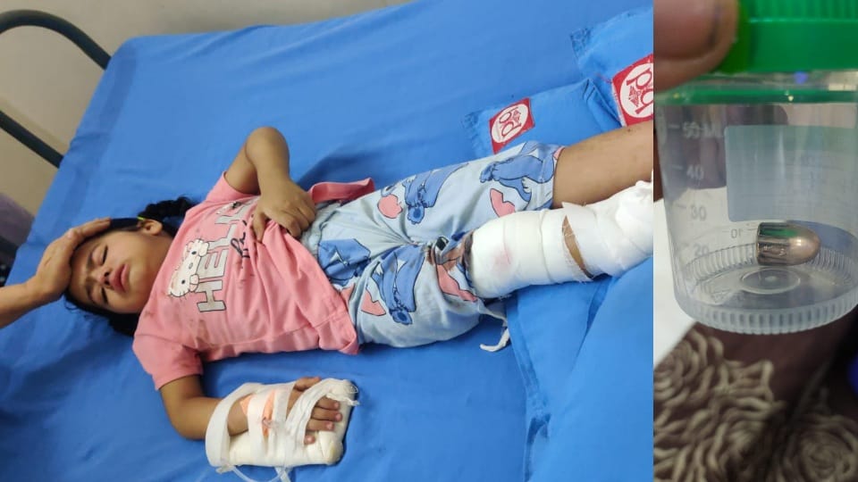 three and half year old girl was injured by bullet in Amritsar