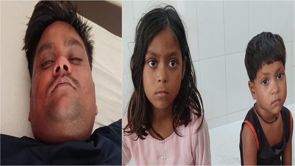 Father's love Bees attacked the children lay down on them to save them condition became critical