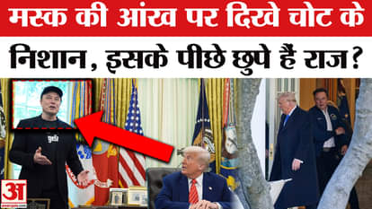 Injury marks seen on Elon Musk's face in the White House, the reason revealed