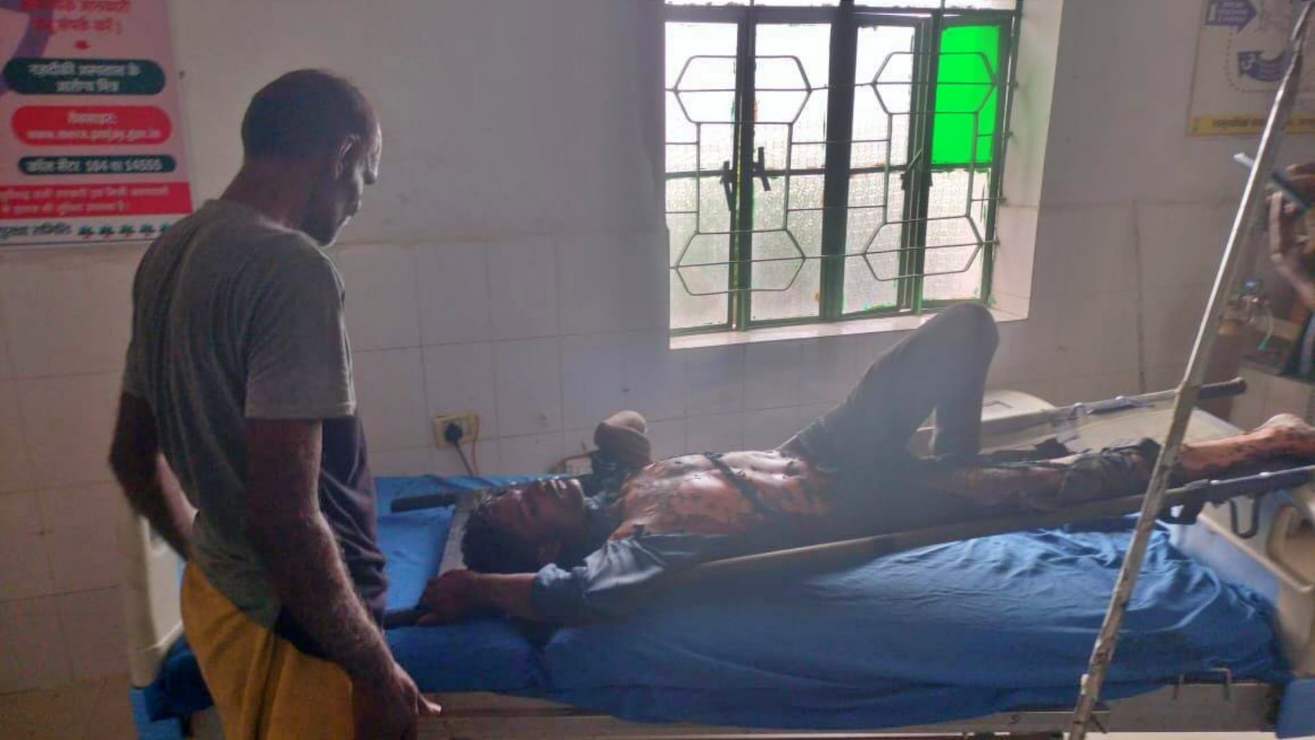 Saharsa News: Youth climbing on roof of train touches high tension wire severely burnt; Railway administration