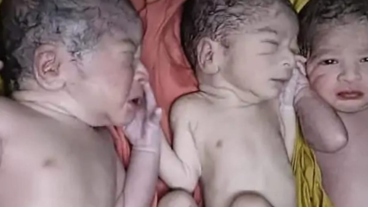 A woman gave birth to three children in Aurai CHC mother and child are safe