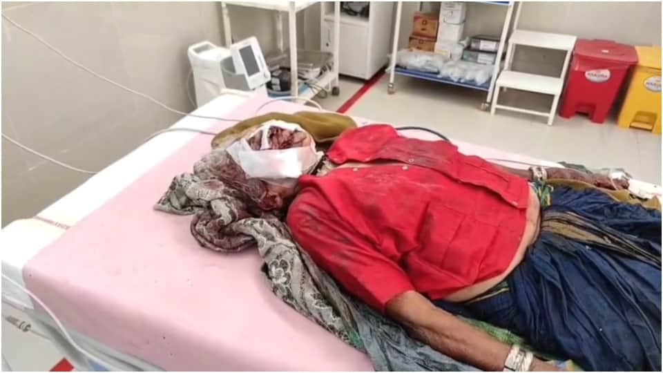 Mysterious Animal Strikes Fear in MP: 6 Dead, 17 Attacked in 12 Days The Shocking Hunt and Untold Story