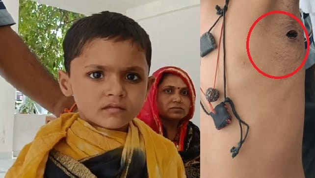 Kanpur Neighbors dog brutally scratched an innocent child the girl was playing outside the house