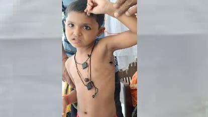Kanpur Neighbors dog brutally scratched an innocent child the girl was playing outside the house
