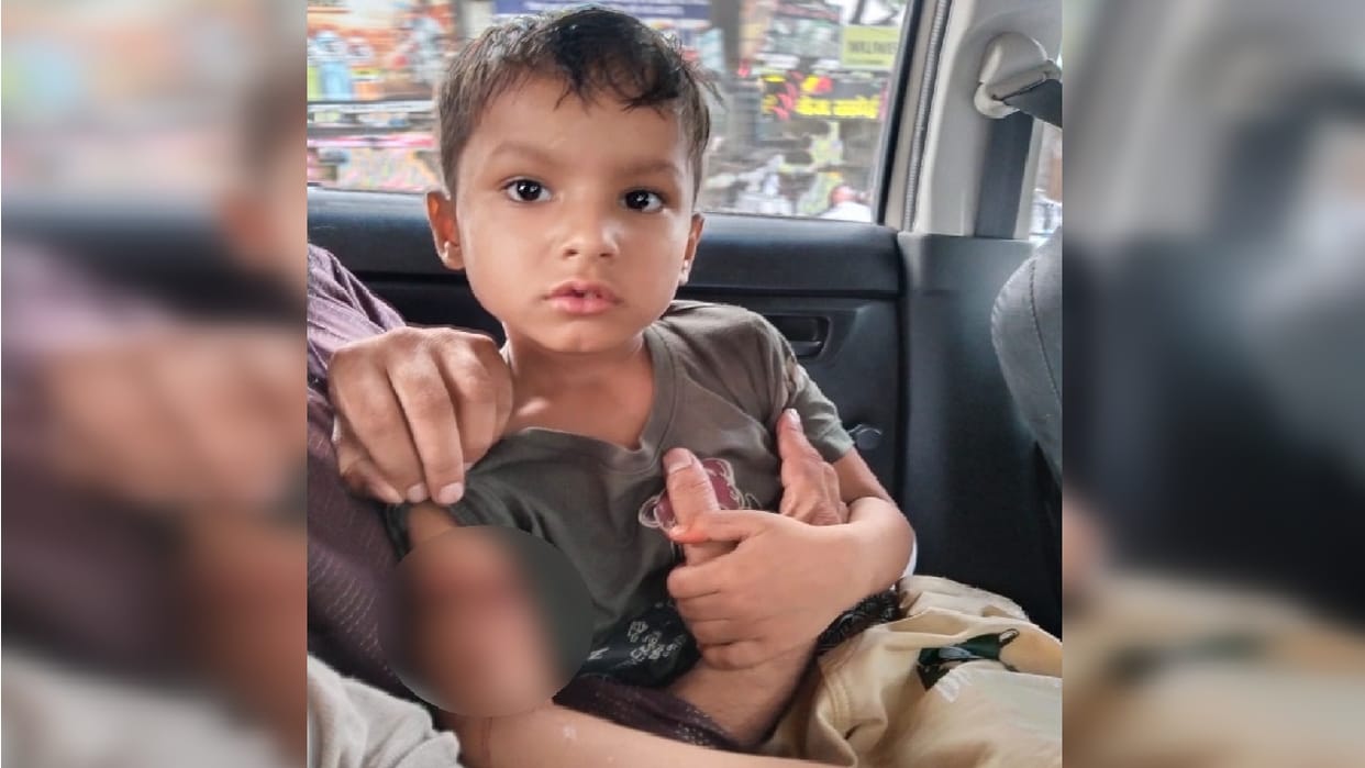 Two children injured by stray dogs in Ghaziabad
