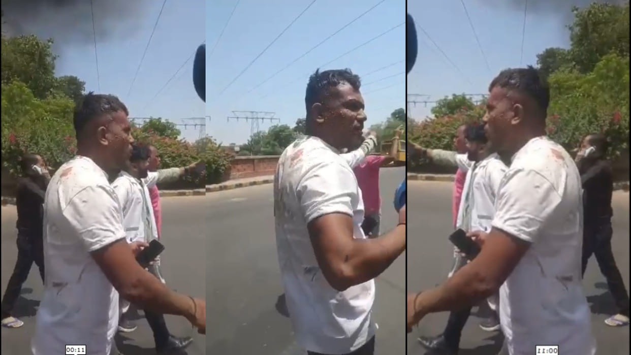 Plane Crash: Whom God protects..., the person who survived the Ahmedabad plane crash, walked to the hospital