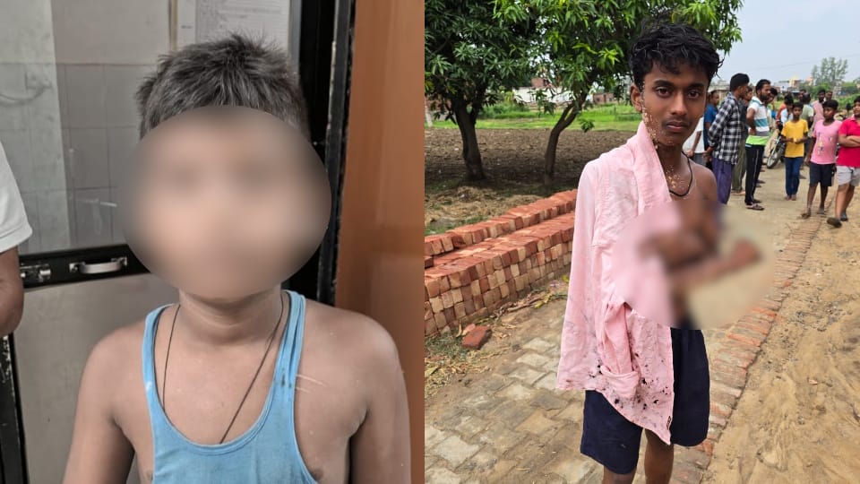 Gorakhpur Crime News Jeweller Throws Acid Over Loan Dispute Teen and Two Children Injured