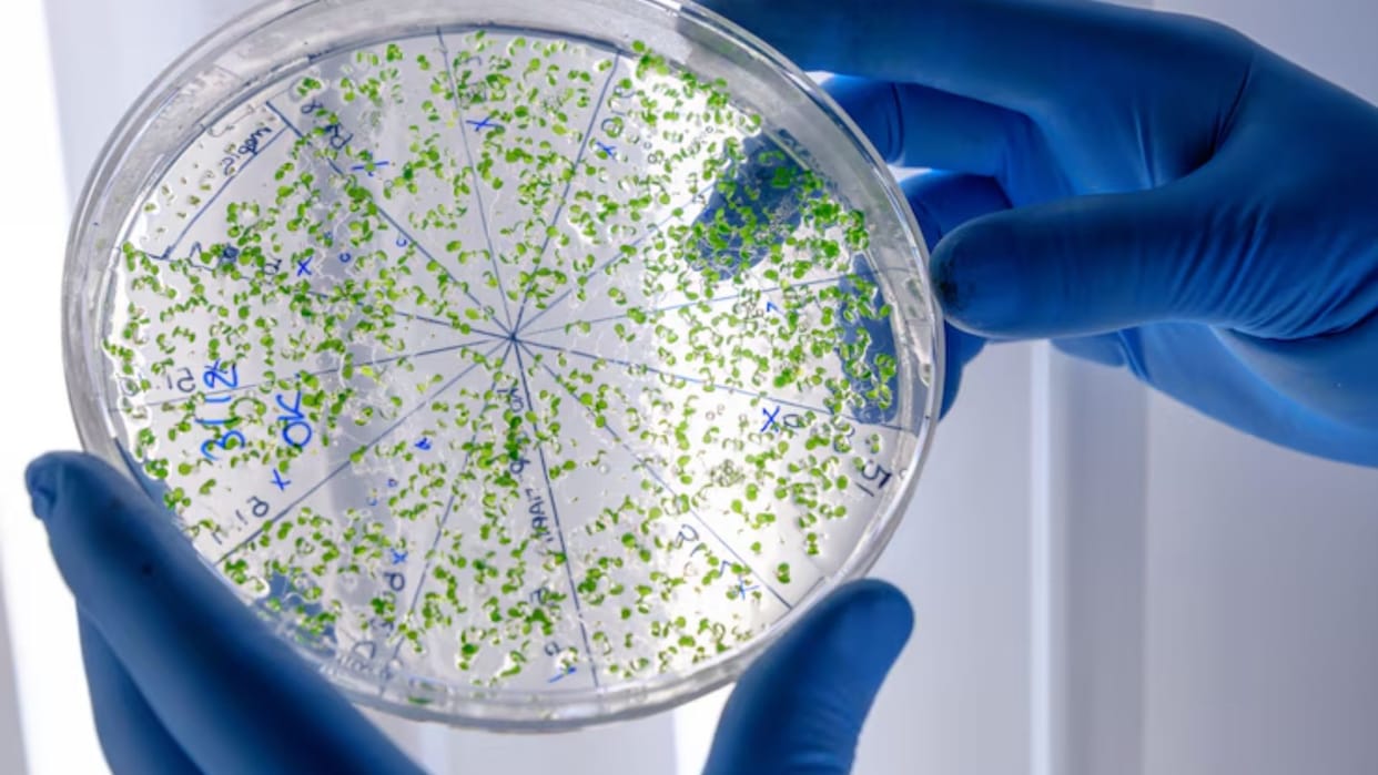 Antibiotic resistance rising in soil bacteria, biggest future challenge for human health system