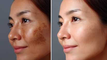 10 रुपये से कम में पाएं नेचुरल ग्लो, ये आसान नुस्खे आएंगे आपके काम