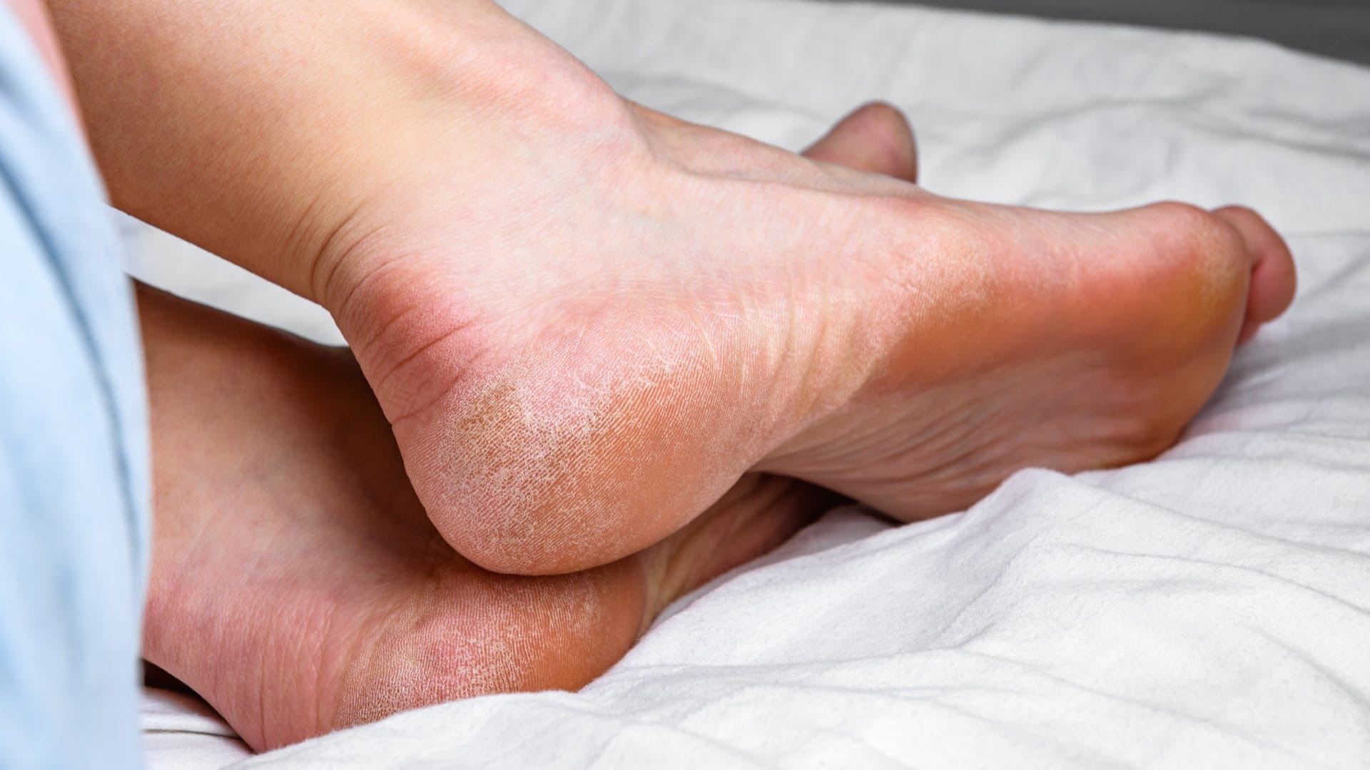 never ignore these symptoms of blood clotting after age of 60