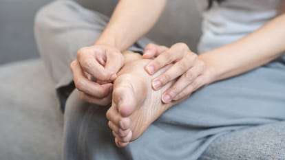 donald trump Diagnosed With Vein Condition chronic venous insufficiency know its symptoms and risk