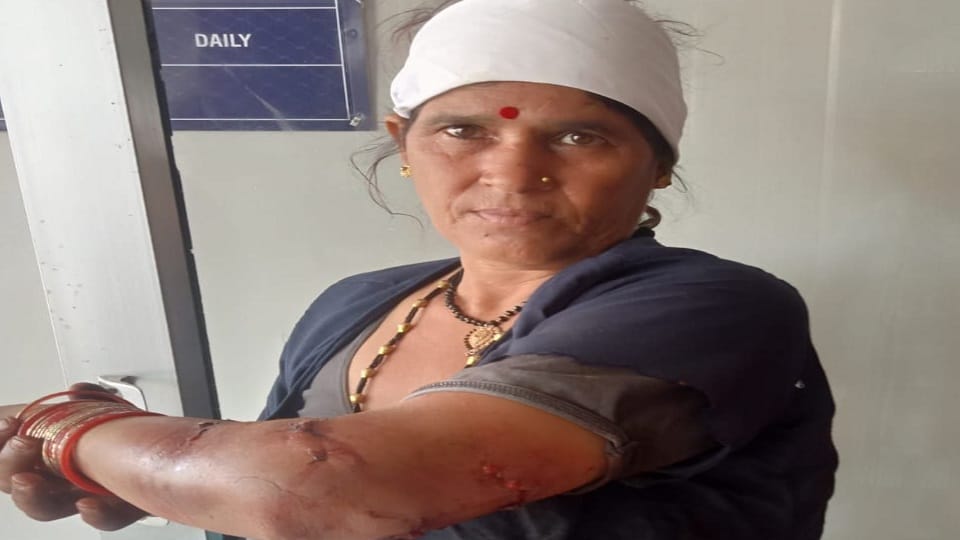 Devaki Devi was returning from the forest with grass for the animals and was attacked by a bear in nanakmatta
