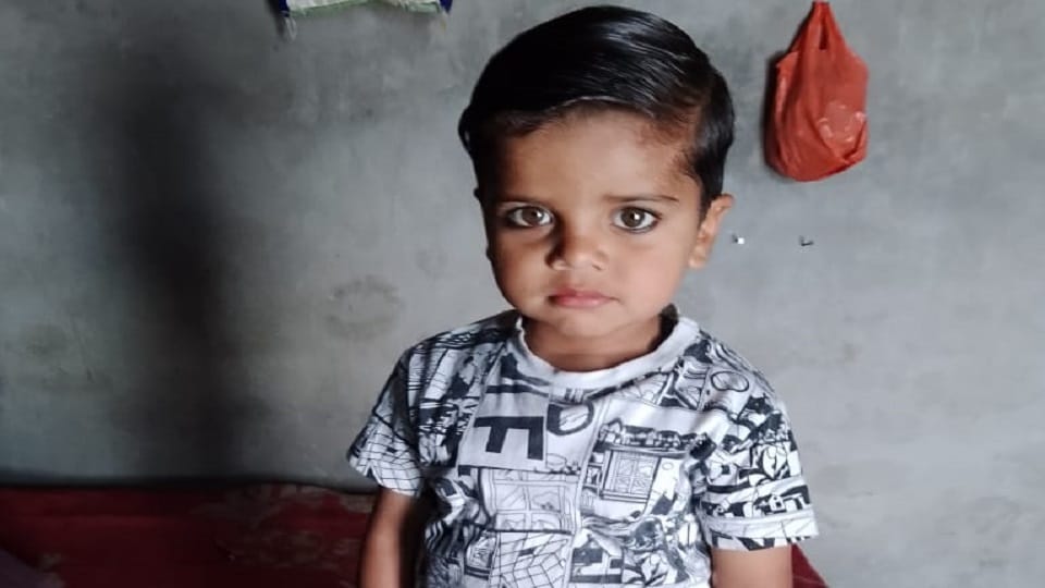 A child burnt by electric current died during treatment