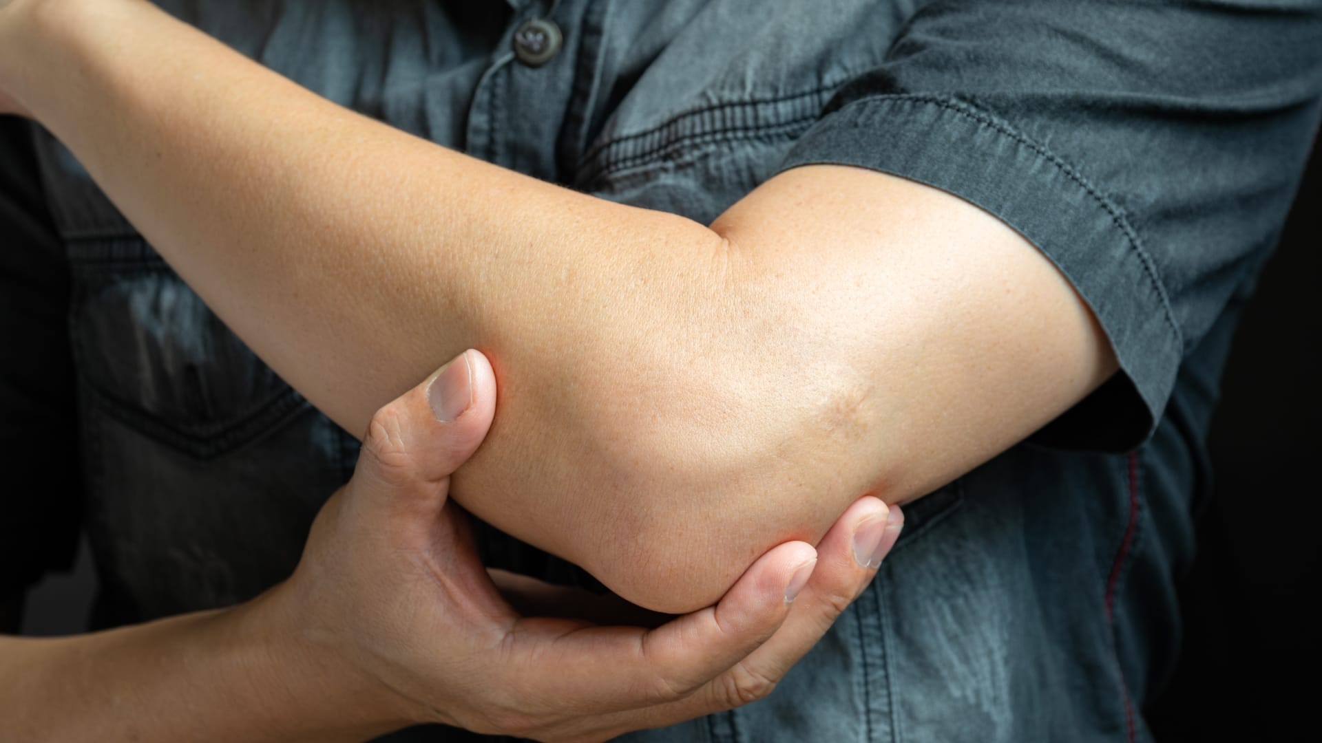 Home Remedies for Dark Elbows and Knees: Natural Ways to Lighten Skin and Remove Dead Cells