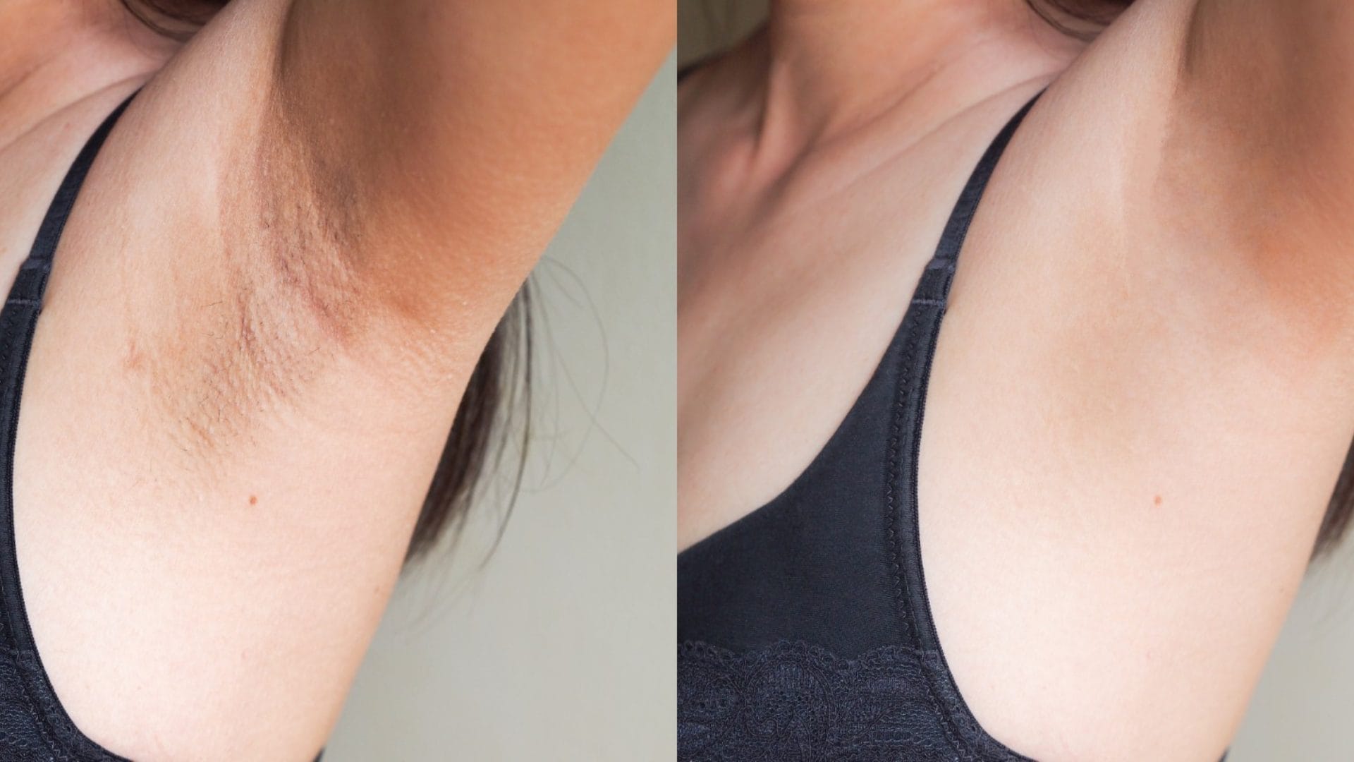 side effect of using hair removal cream in hindi