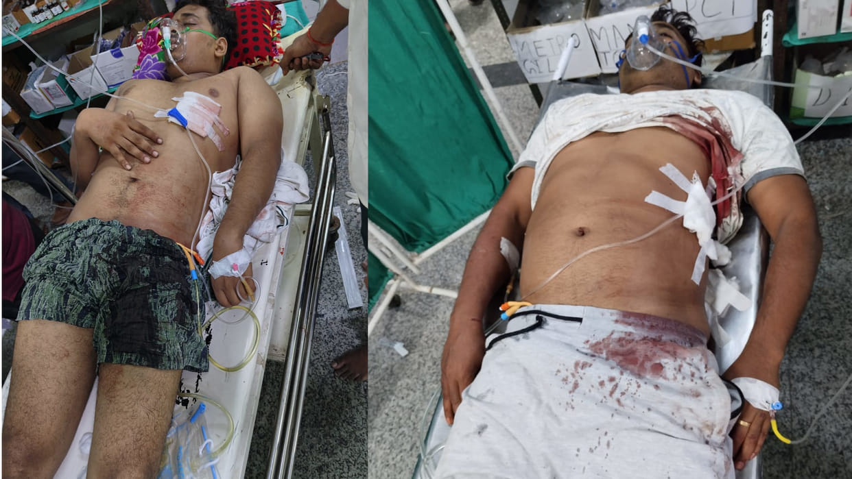 In Gorakhpur, Bullion trader and his son shot in a dispute, condition critical