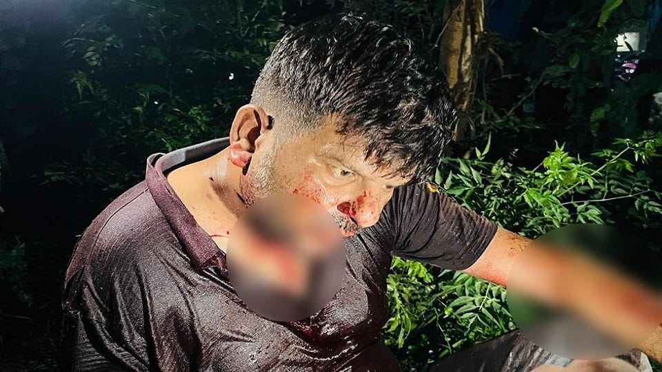 Amroha: Farmer's neck cut in a moving car, vehicle saved from overturning, condition critical