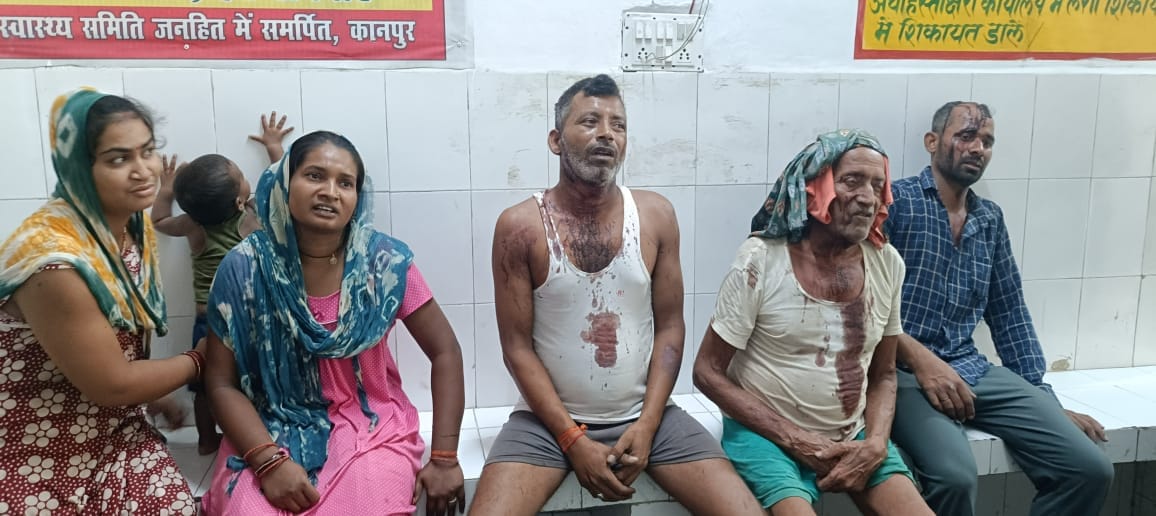 Kanpur Bloody clash between two parties Nine people seriously injured police busy investigating