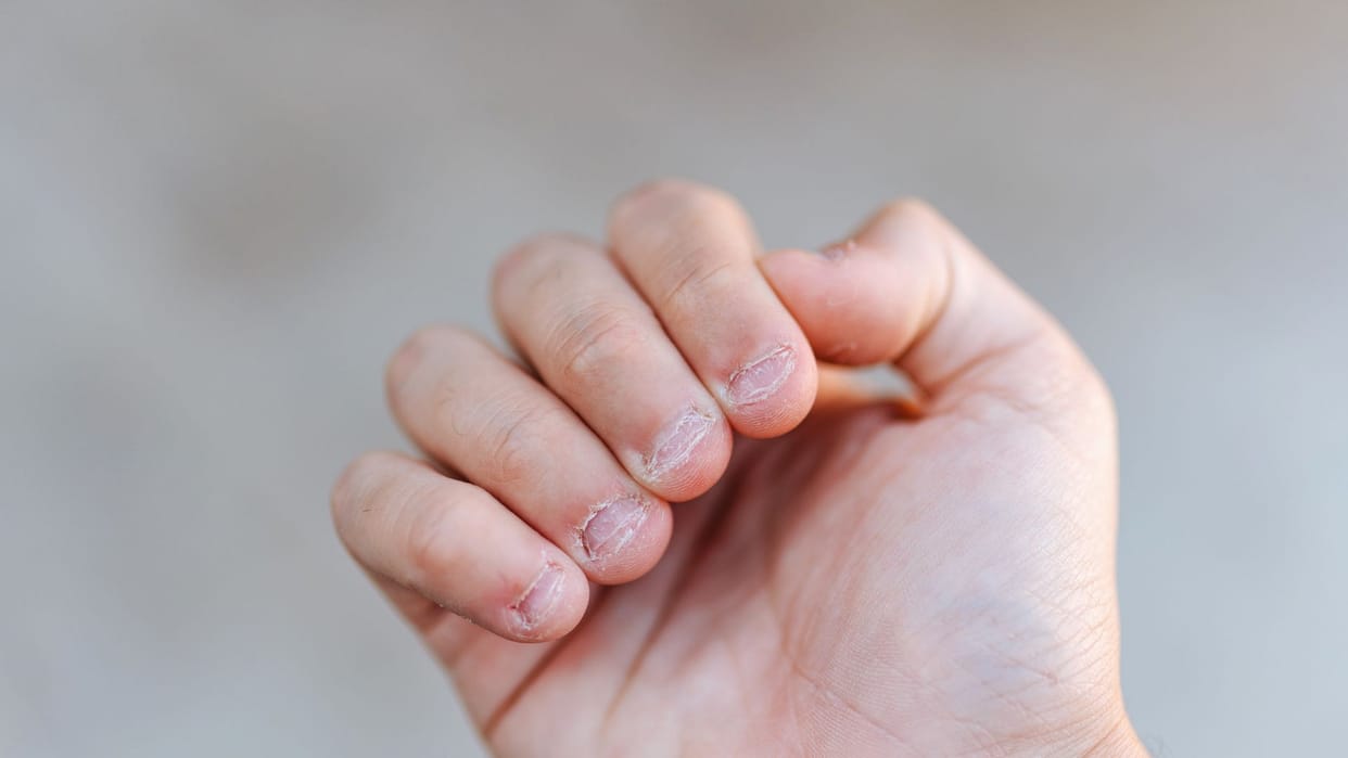 Nail Health Sign 4 Hidden Sign  in Nail Color and Texture Say About Your Health