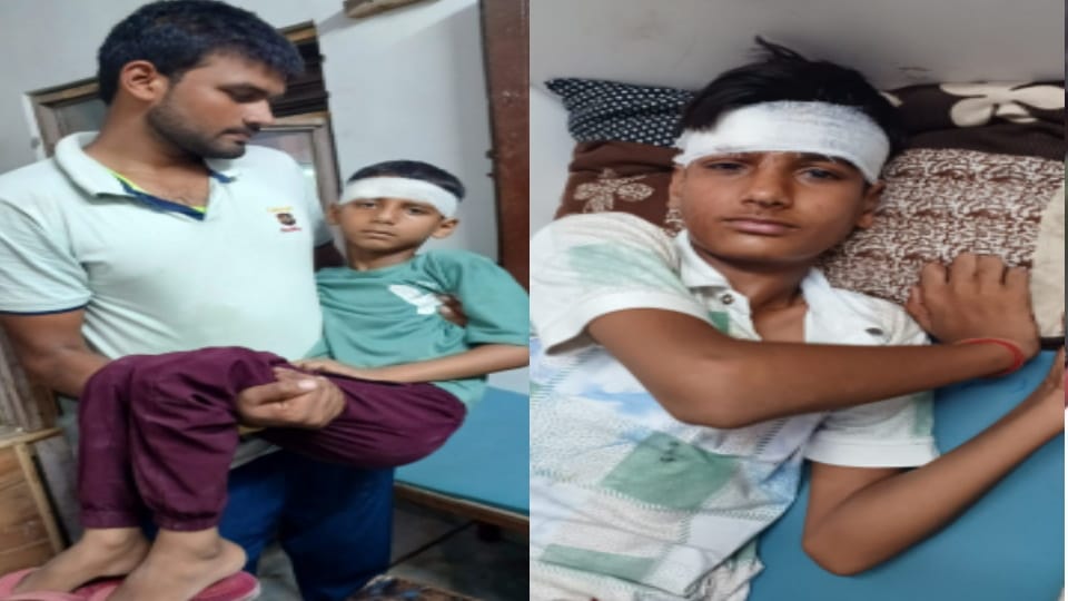 Ratol: Monkey Menace in Lahchaura, Four Children Injured While Playing on Rooftop