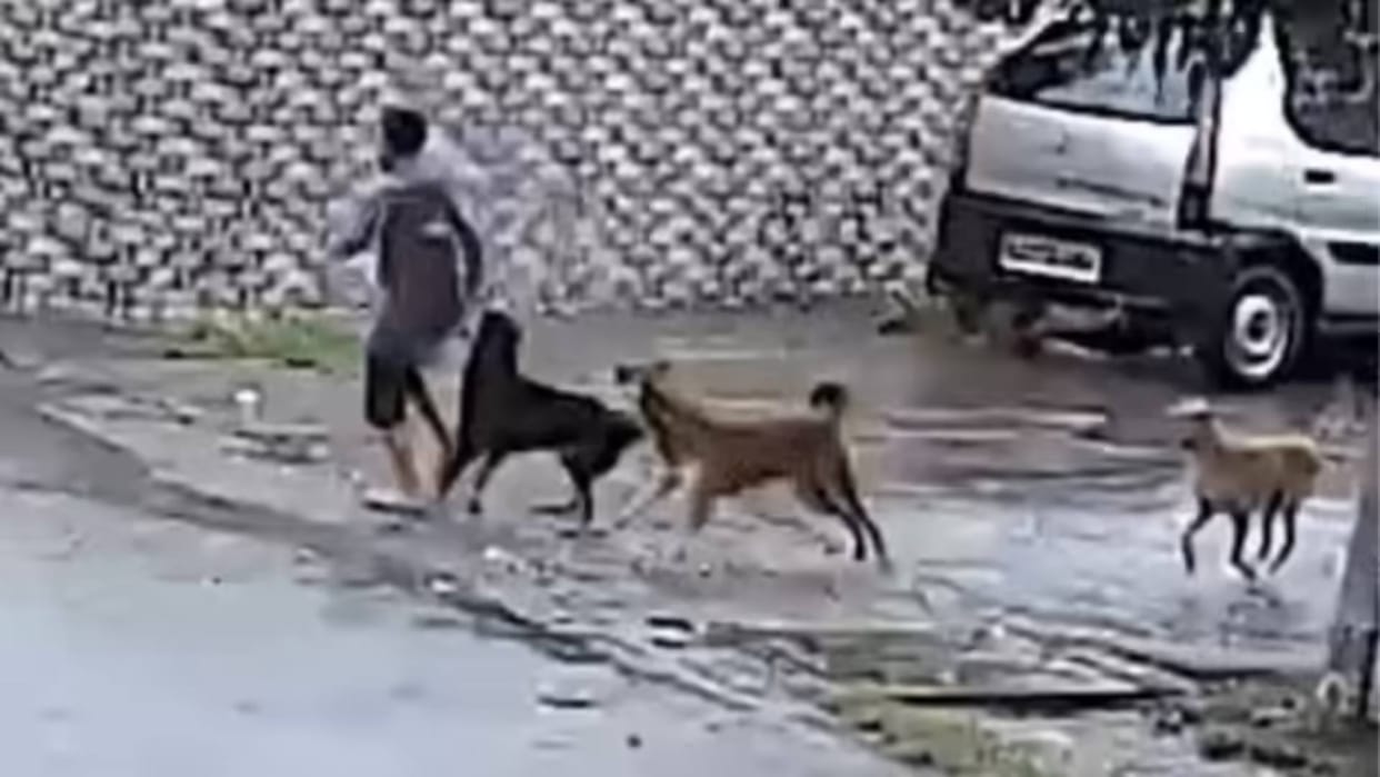 Four dogs attacked a boy scratched him mercilessly two women kept watching Video goes Viral