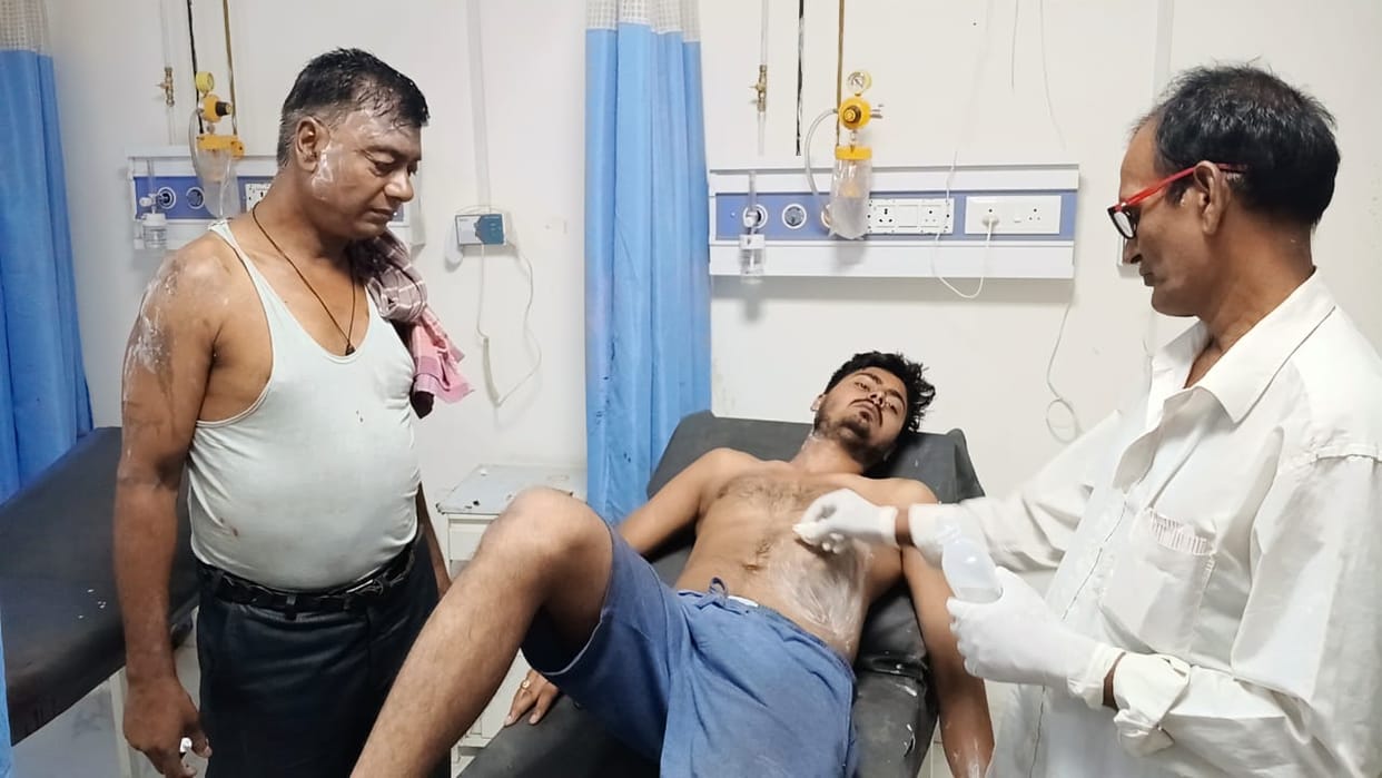 Bihar: Violent clash between two parties in Siwan, one party threw acid and the other attacked with a sword