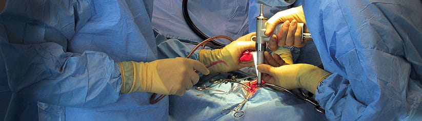 UP: Now broken hips will be joined with cement instead of screws, this is how the surgery will be done; This e