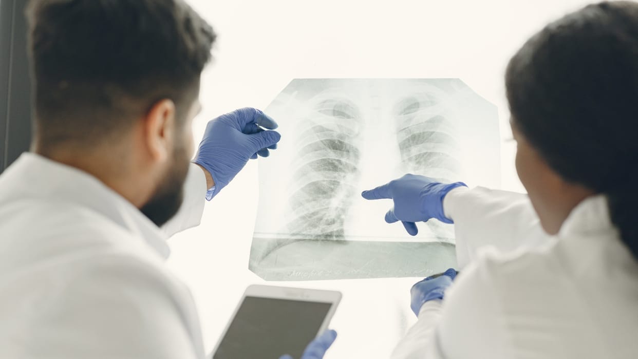 ICMR reveals 76 Percent TB patients benefited from nutrition scheme in five years