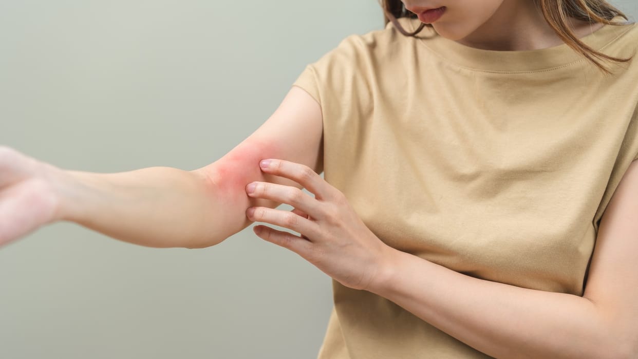 home remedy for body itching in monsoon season skin ki khujli kaise dur kare