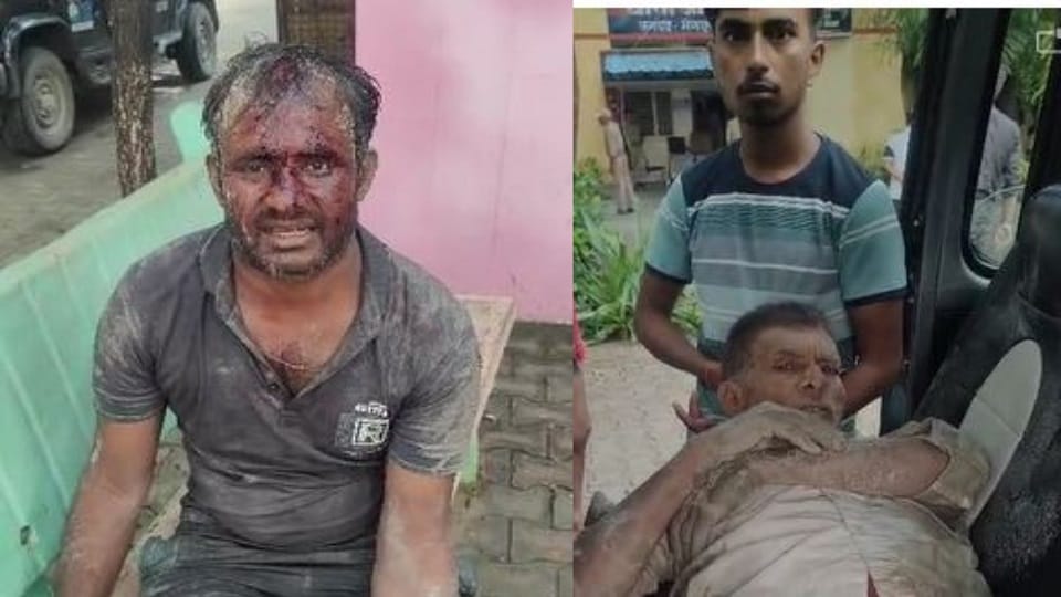 Fight between brothers for farm one injured in firing