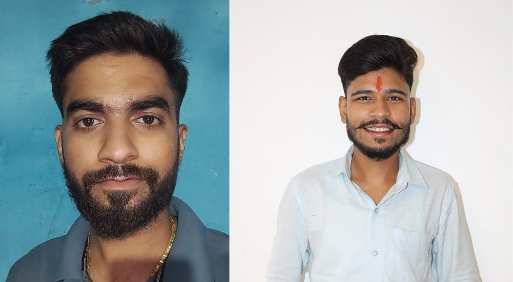 Kanpur Dog bites five people including a doctor in CMO office CMO says Municipal Corporation has been informed