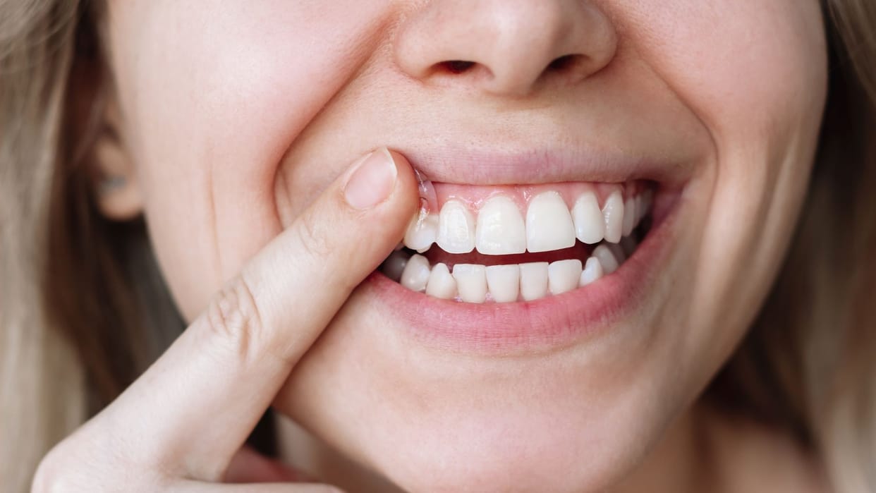 FDA Restricts Fluoride Supplements for Kids Under 3 Amid New Health Risk Concerns