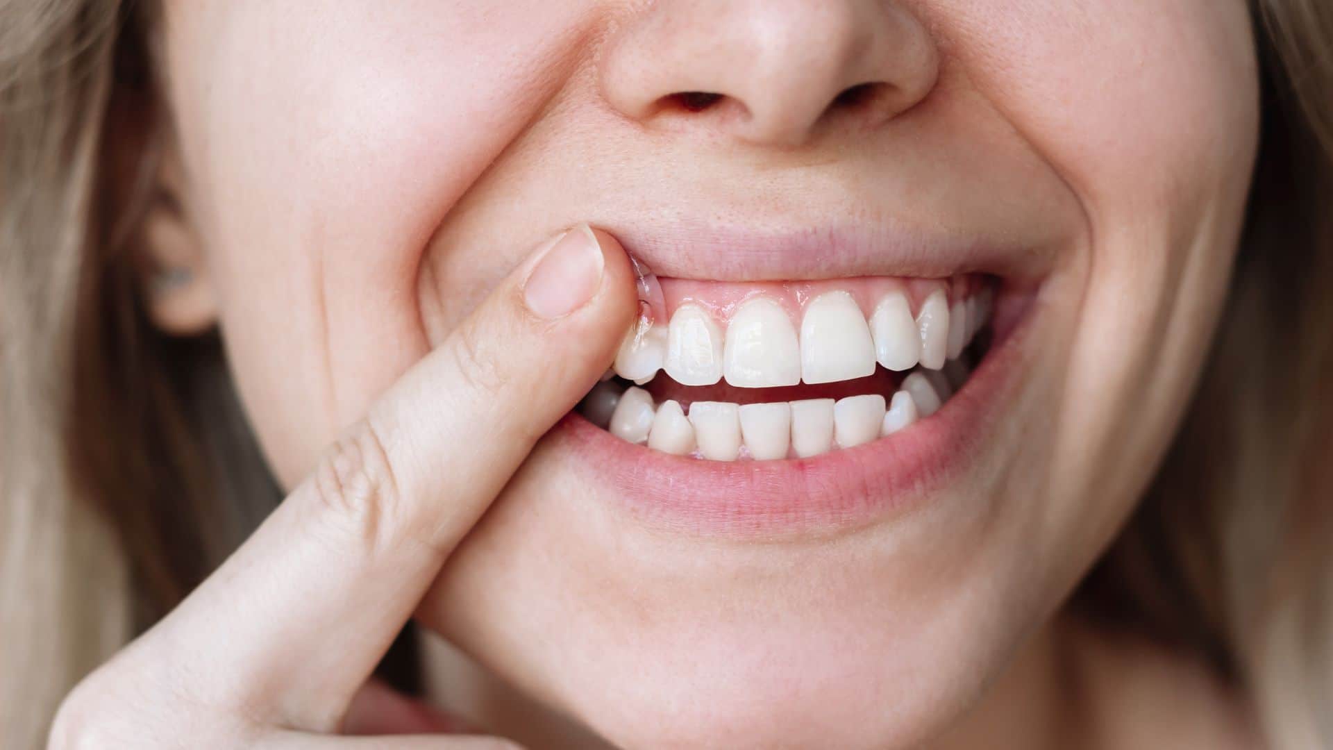 Brushing Mistake to Avoid Know How It Damages Teeth Oral health Care Tip