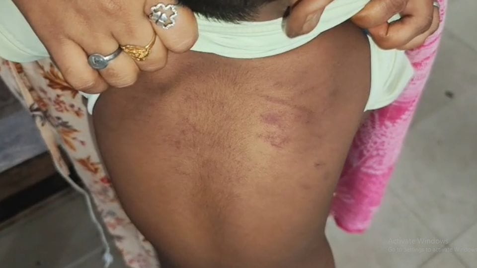Police took the teacher into custody who brutally beat up a student in Raigarh