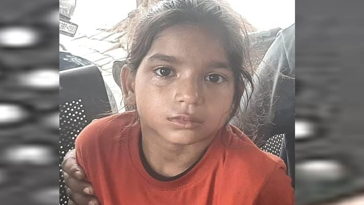 Etawah: A monkey entered the house and injured the innocent child, child was playing