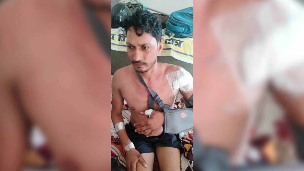 boy was attacked with a chicken cutting knife for not returning Rs 300 In Faridabad