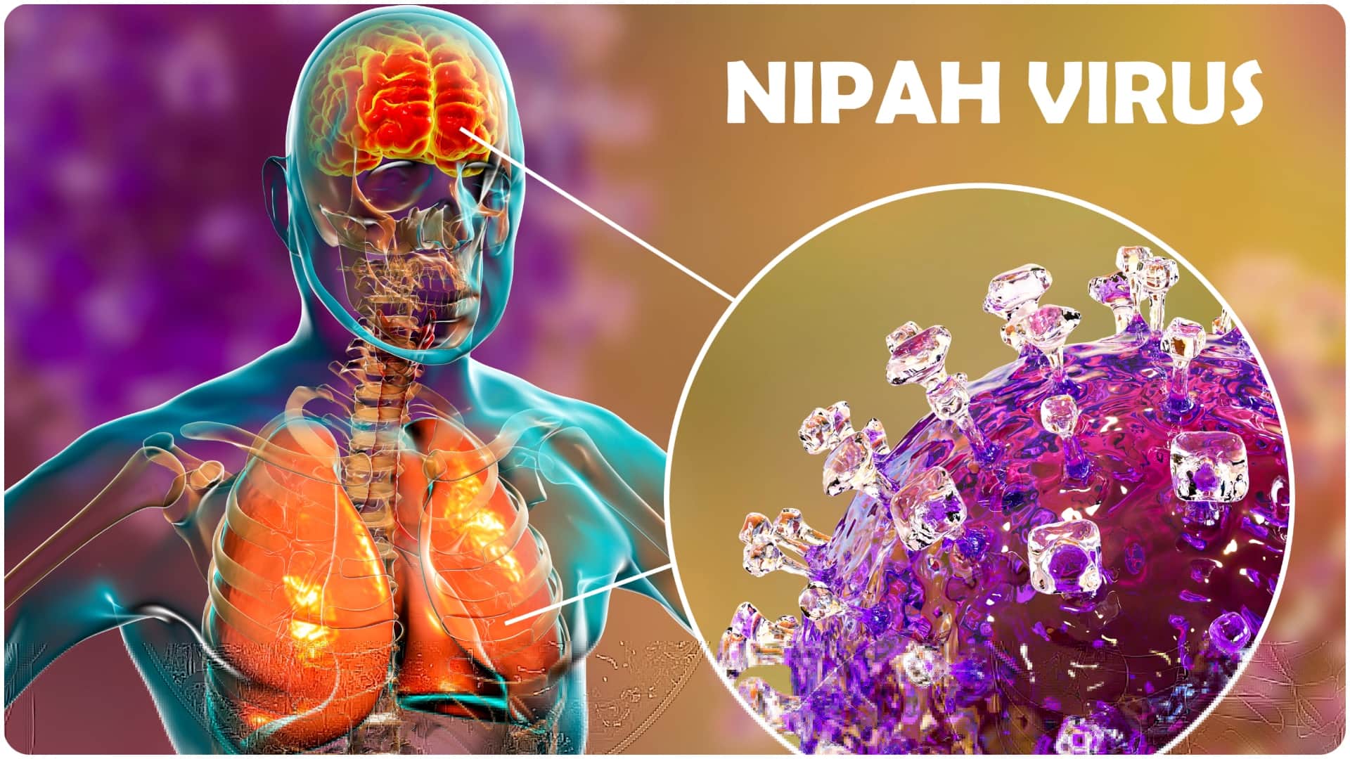 first case of a Nipah virus-related death in West Bengal know why is nipah virus so deadly