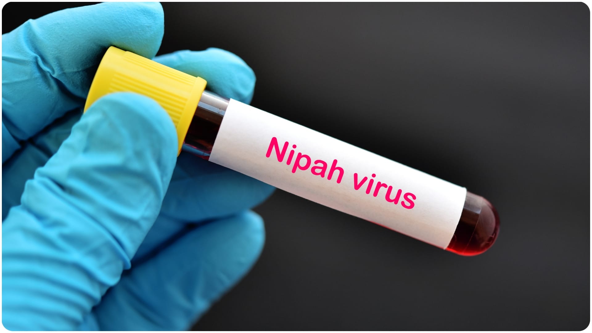 nipah virus in west bengal latest news details about nipah virus in hindi