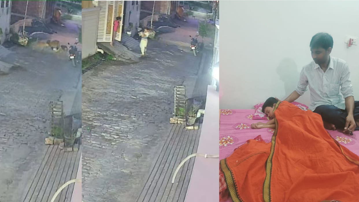 Dogs dragged the child from the door, dragged him on the road and scratched him in Kushinagar