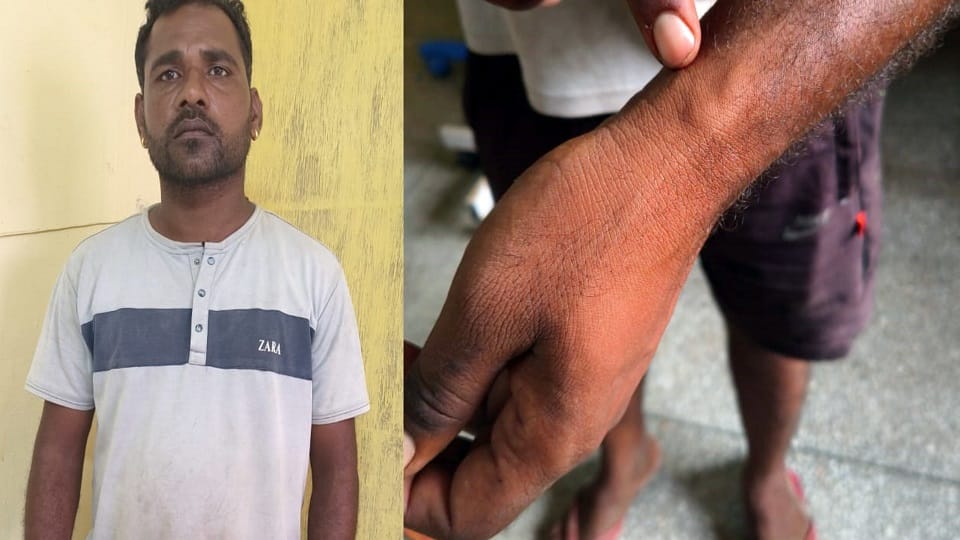 Beaten with sticks body turned blue police did this to young man family members were terrified