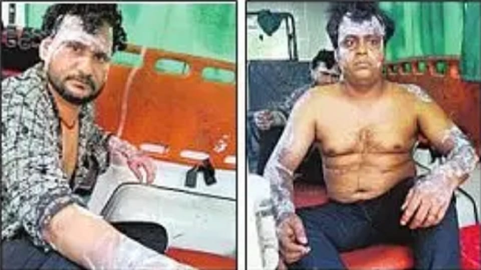 Explosion in mixing bucket while making paint, ten workers burnt