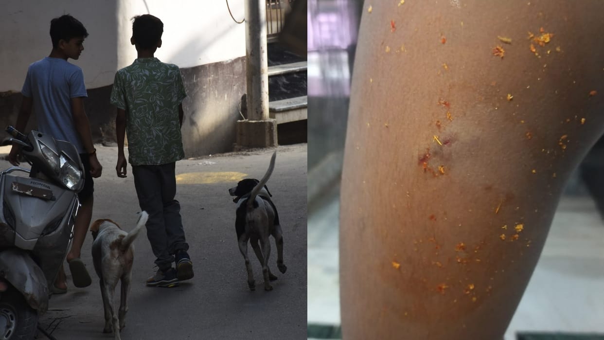 Even after 94 thousand sterilizations terror dogs not stopped population Lucknow more than 1.10 lakh