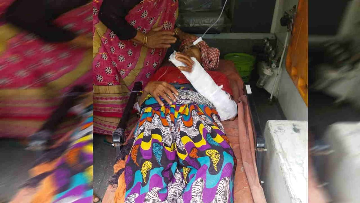 Pig attacked a woman and badly injured her Devprayag Srinagar Garhwal