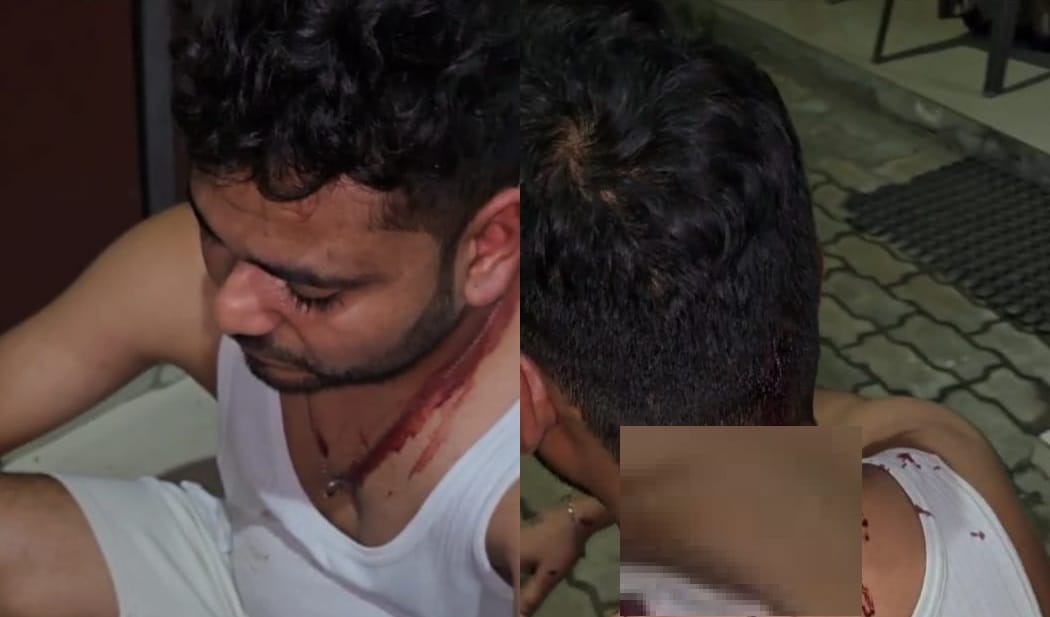 Kanpur KDA JE assaulted and abused employee injured while trying to intervene accused of snatching mobile