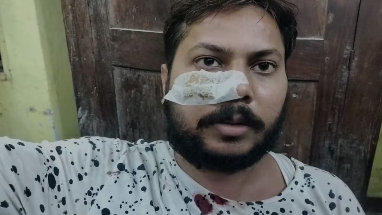 Bihar News: Shots Fired at Shiv Shakti Rudra Mahayagya, Two Youths Injured, Tension Grips Locals