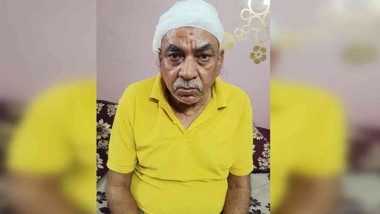 Hotel operator beaten up for asking for money