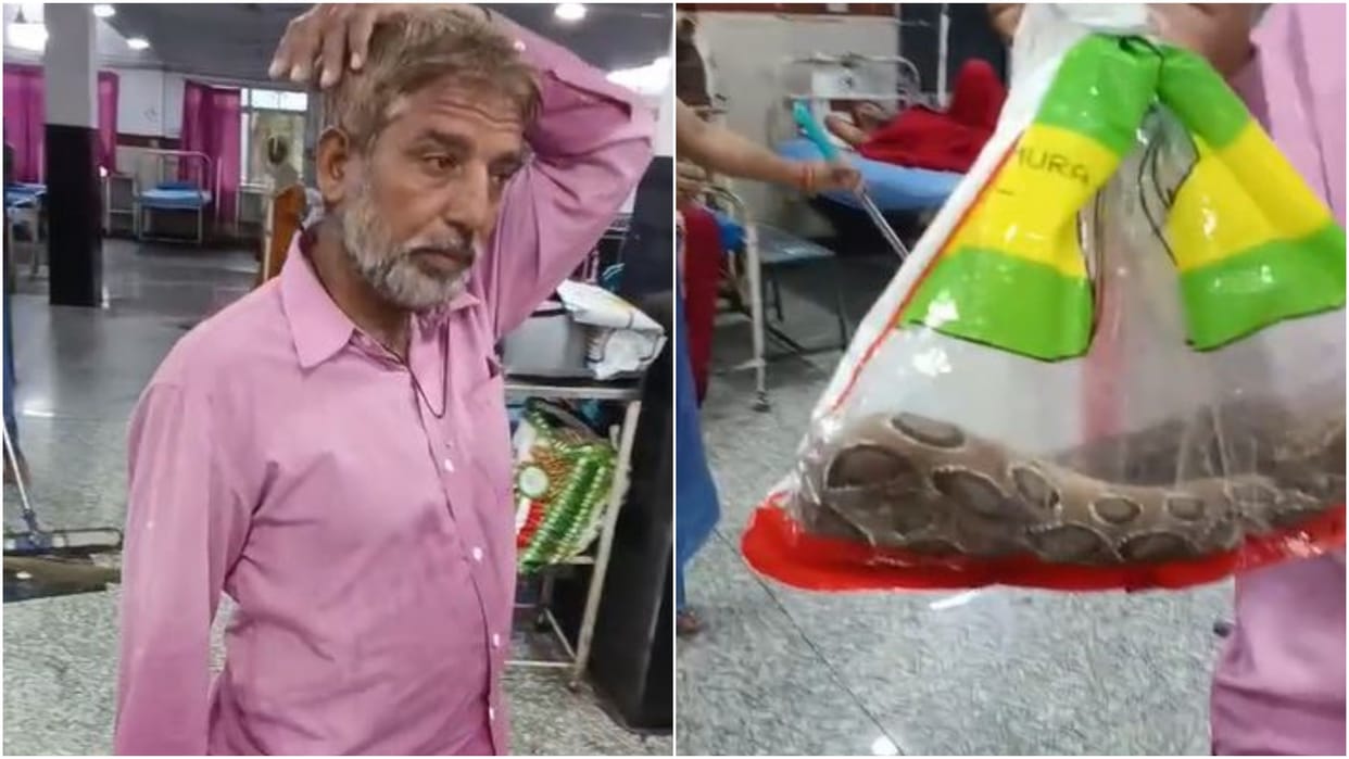 Udaipur News: Man Brings Snake in Bag to Hospital After Bite, Timely Treatment Saves Life