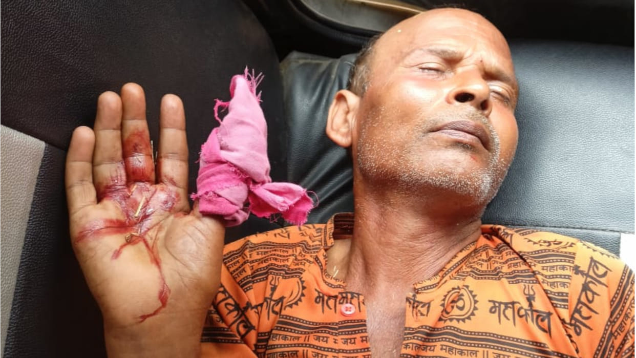 Unknown assailants attacked a couple with a sharp weapon in Deoria