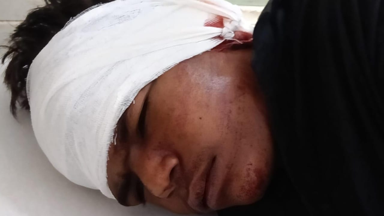 17-year-old Nilesh fought with tiger in Pilibhit Harvansh also fought to save his friend