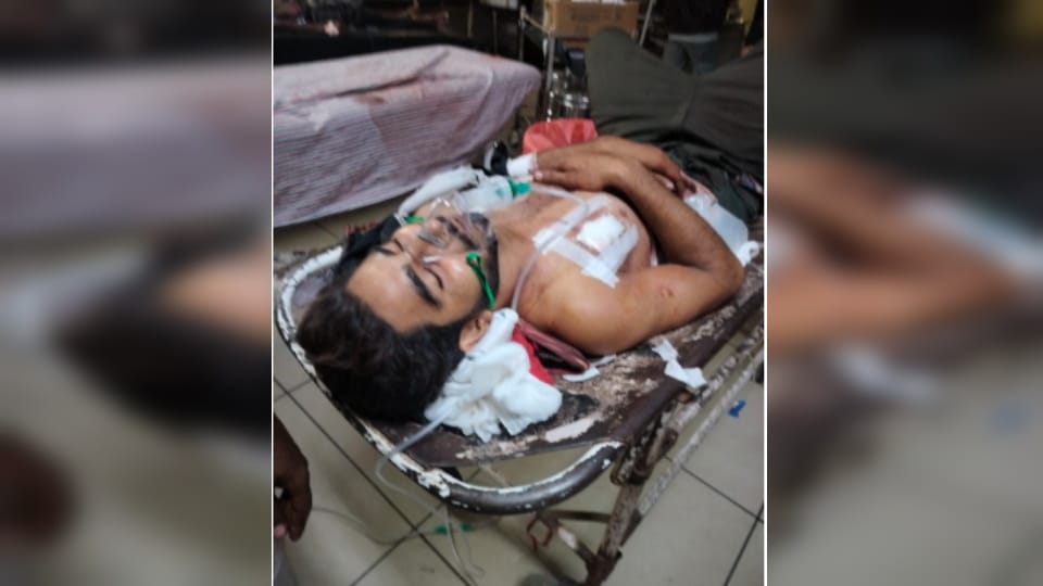 Shamli: Youth shot inside house in Mukundpur village, critical; one attacker caught